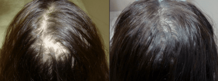 Anti Hair Loss Growth Serum