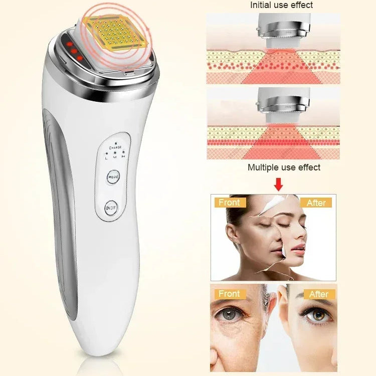 HexoLift™ – Dot Matrix Facial Lifting &amp; Skin Rejuvenation Device