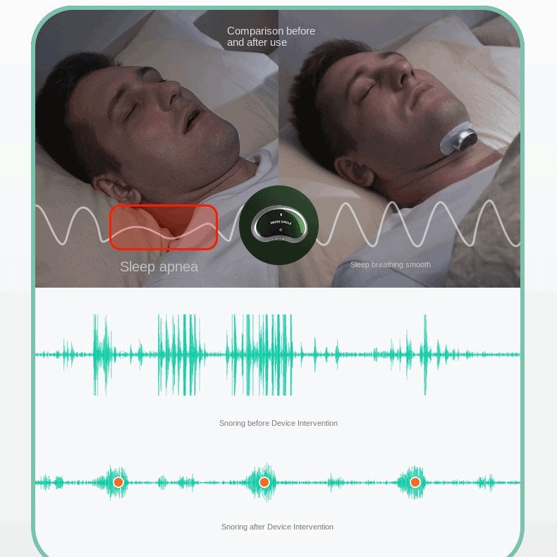 HexoSleep™ Smart Snore Stopper