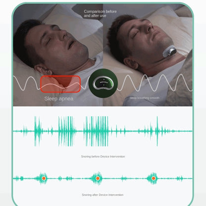 HexoSleep™ Smart Snore Stopper