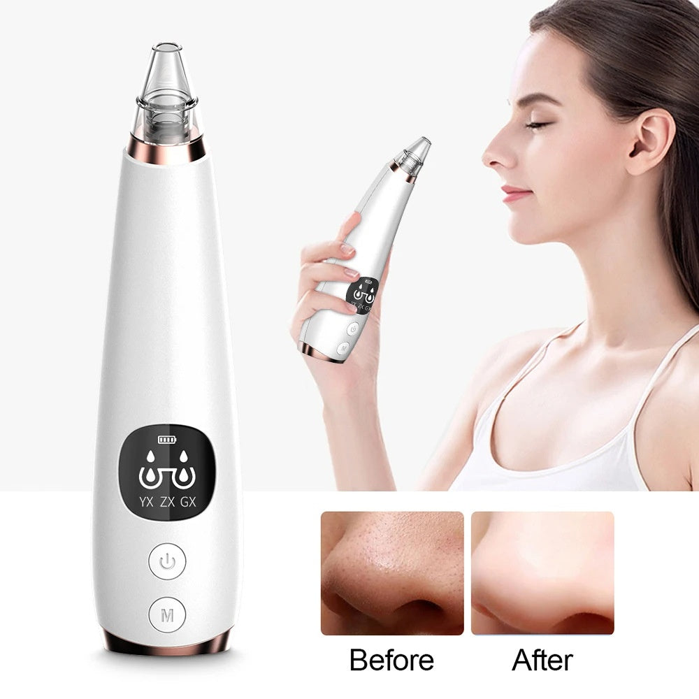 HexoClear™ – Electric Pore Vacuum &amp; Blackhead Remover