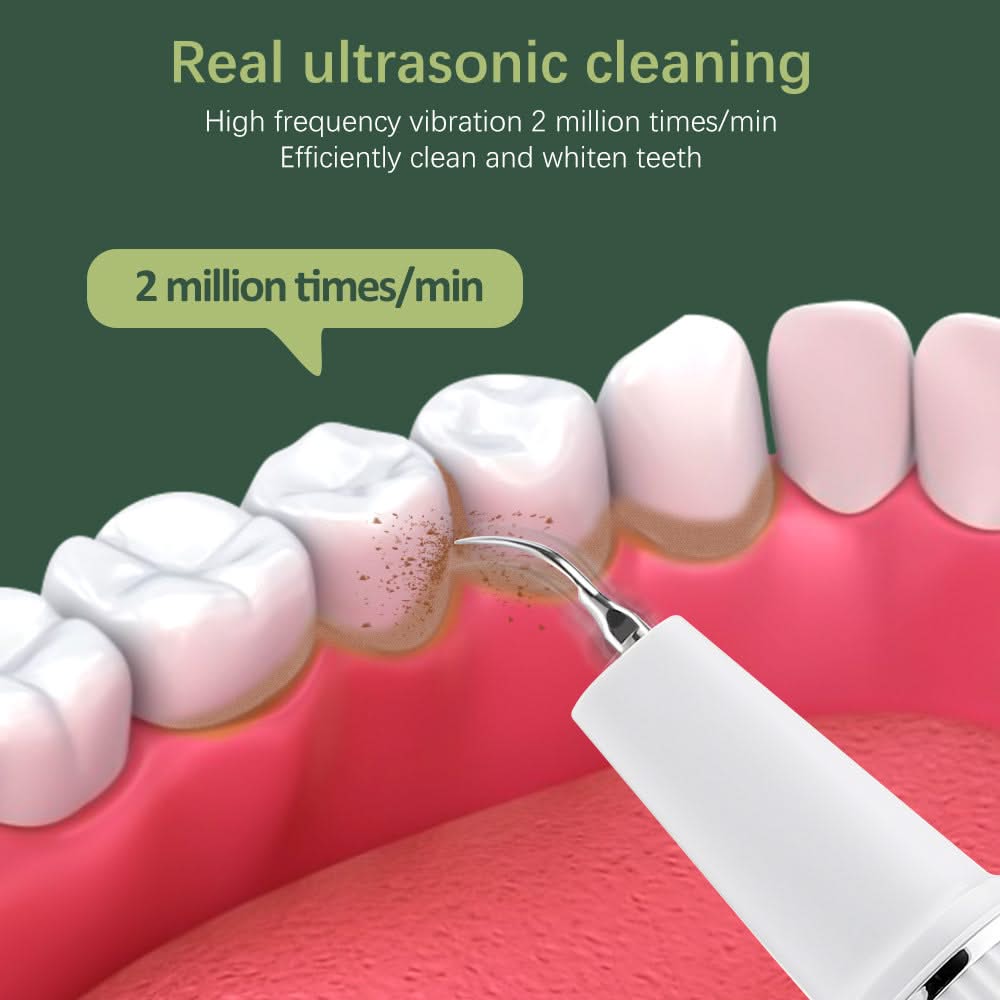 HexoTeeth™ Ultrasonic Tooth Cleaner with Camera