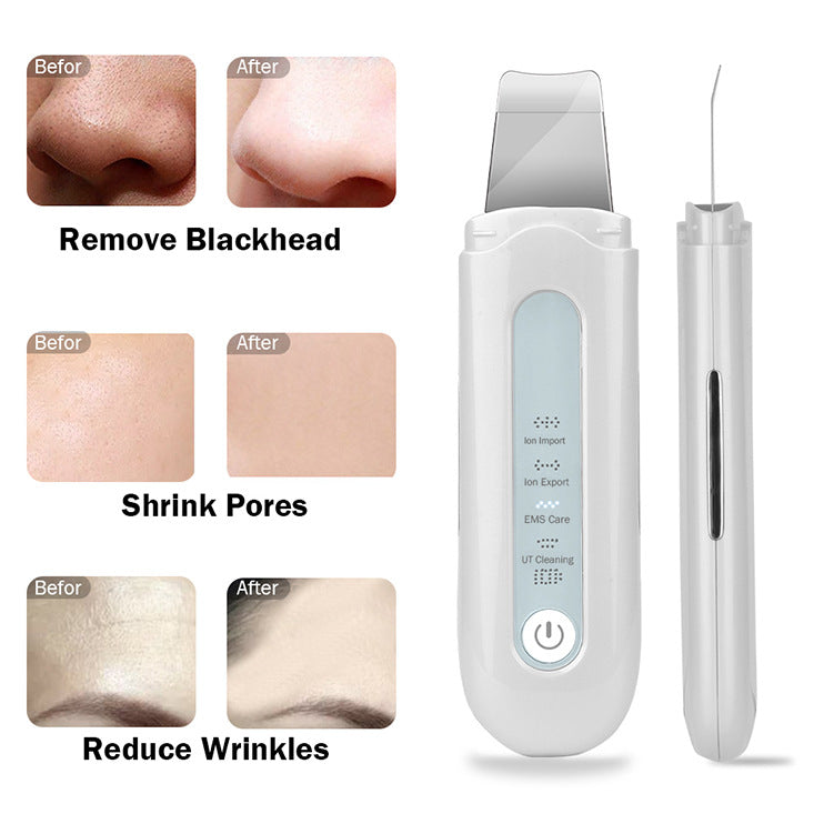 HexoSkin™ Ultrasonic Deep Clean Skin Scrubber