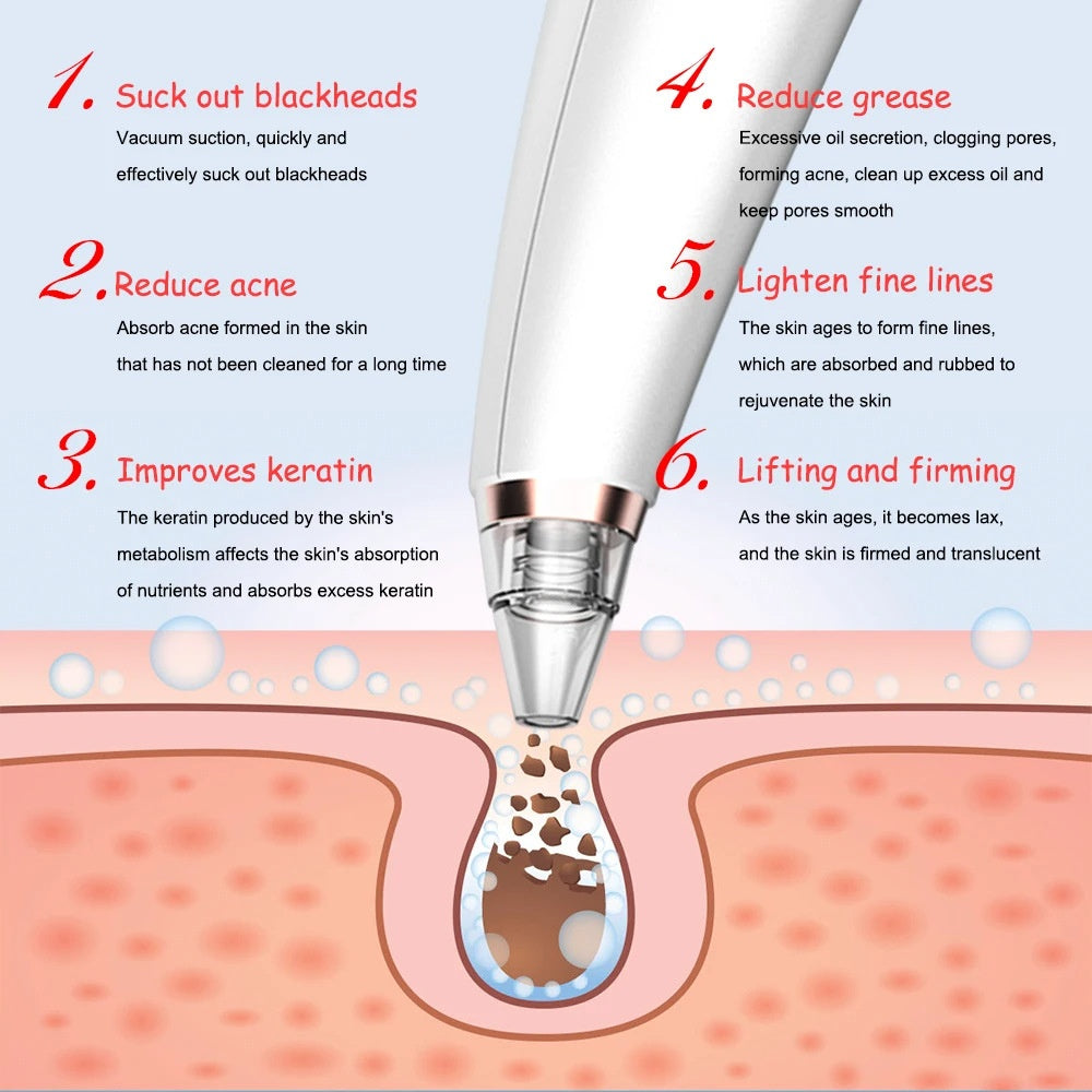 HexoClear™ – Electric Pore Vacuum &amp; Blackhead Remover