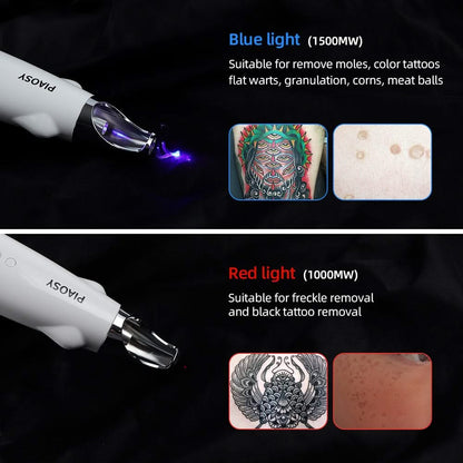 PIAOSY™ Picosecond Pen for Tattoo, Dark Spot & Acne Scar Removal