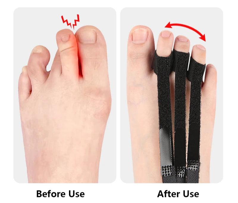 HexoFoot™ Toe Correction Splint