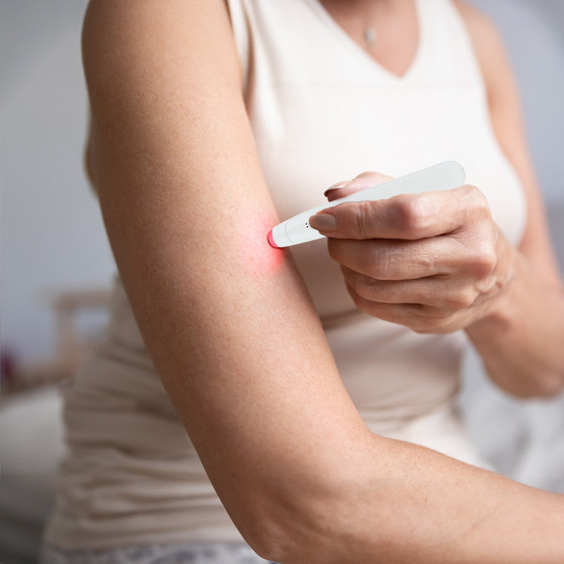 HexoBite™ Itch Relief Pen for Mosquito Bites – Rechargeable, Chemical-Free for All Ages