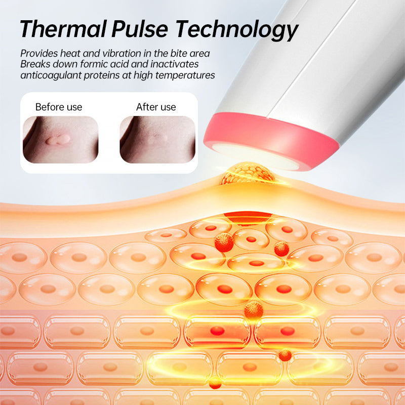 HexoBite™ Itch Relief Pen for Mosquito Bites – Rechargeable, Chemical-Free for All Ages