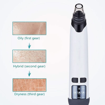 HexoSkin™ – Blackhead Remover with Heat & Adjustable Suction