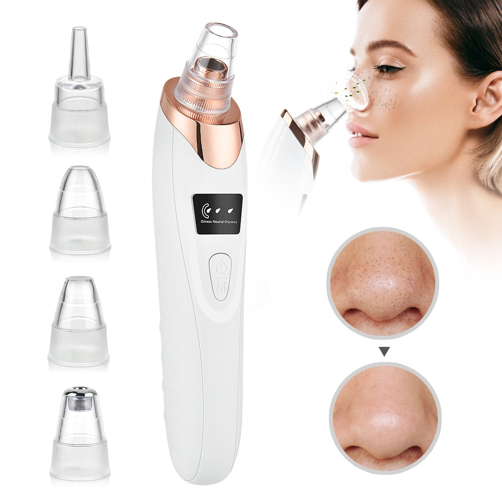 HexoClear™ Vacuum Blackhead Remover