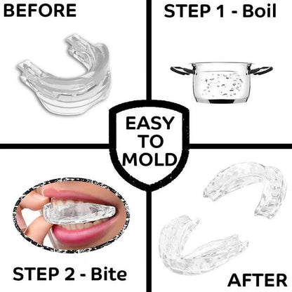 HexoSleep™ Mouth Guard For TMJ & Jaw Pain Relief