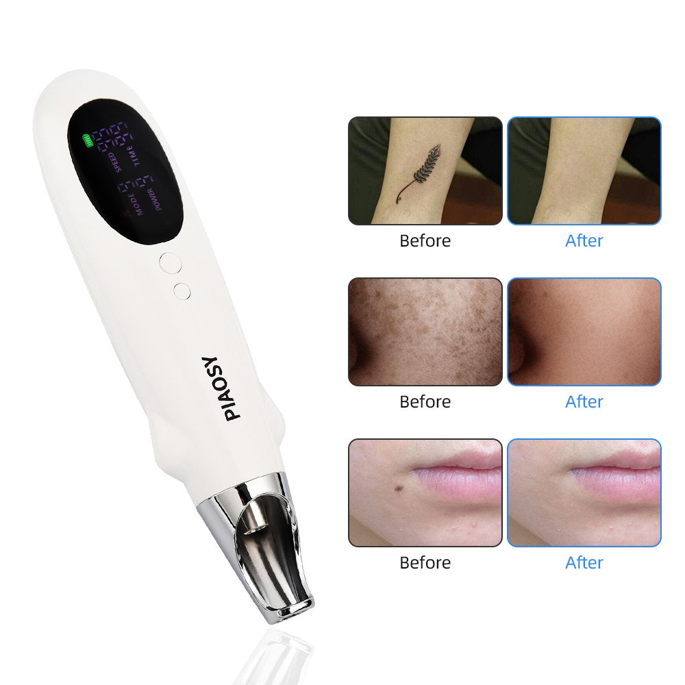 PIAOSY™ Picosecond Pen for Tattoo, Dark Spot &amp; Acne Scar Removal