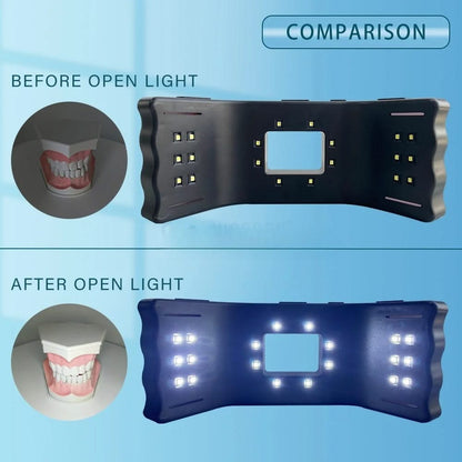 HexoSmile™ – LED Dental Fill Light for Precision Oral Photography