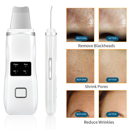 HexoSkin™ Ultrasonic Skin Scrubber