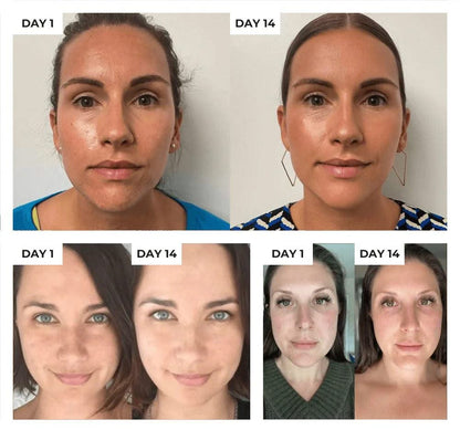 HexoSkin™ Anti-Aging Skincare Wand
