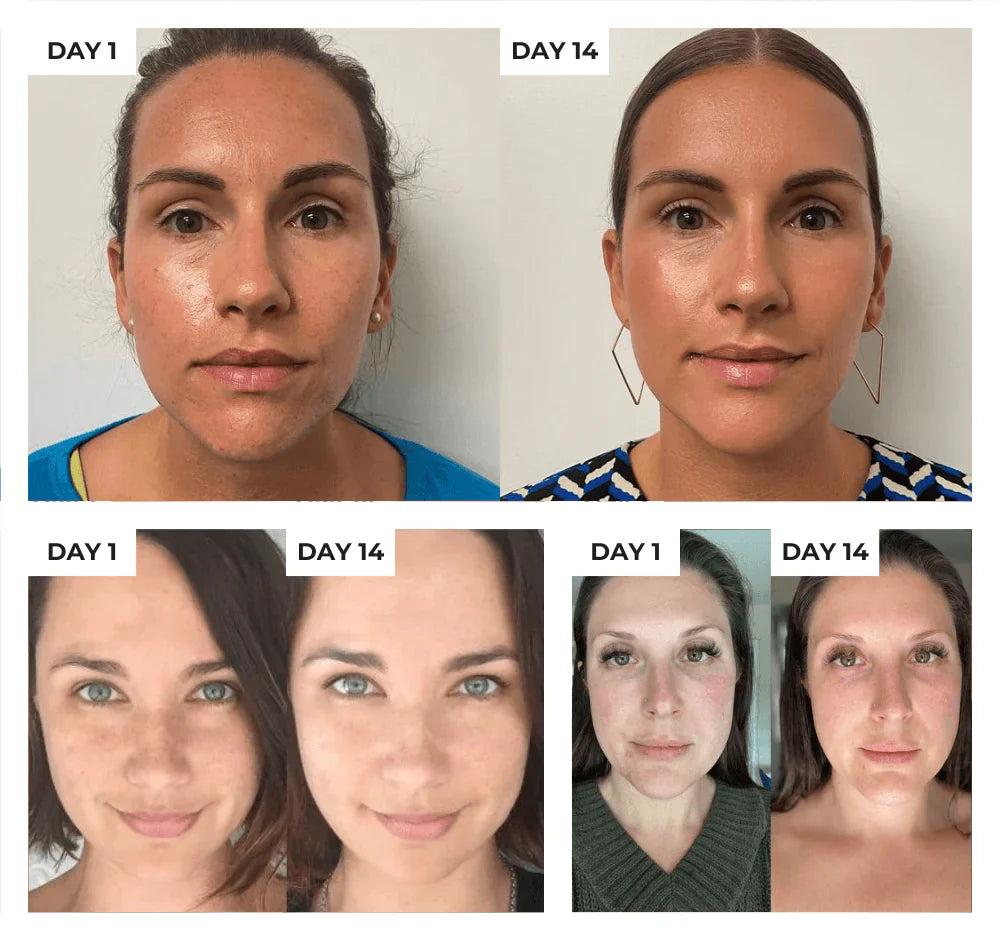 HexoSkin™ Anti-Aging Skincare Wand