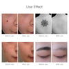 Neatcell™ – Picosecond Laser Remover For Tattoos &amp; Spots