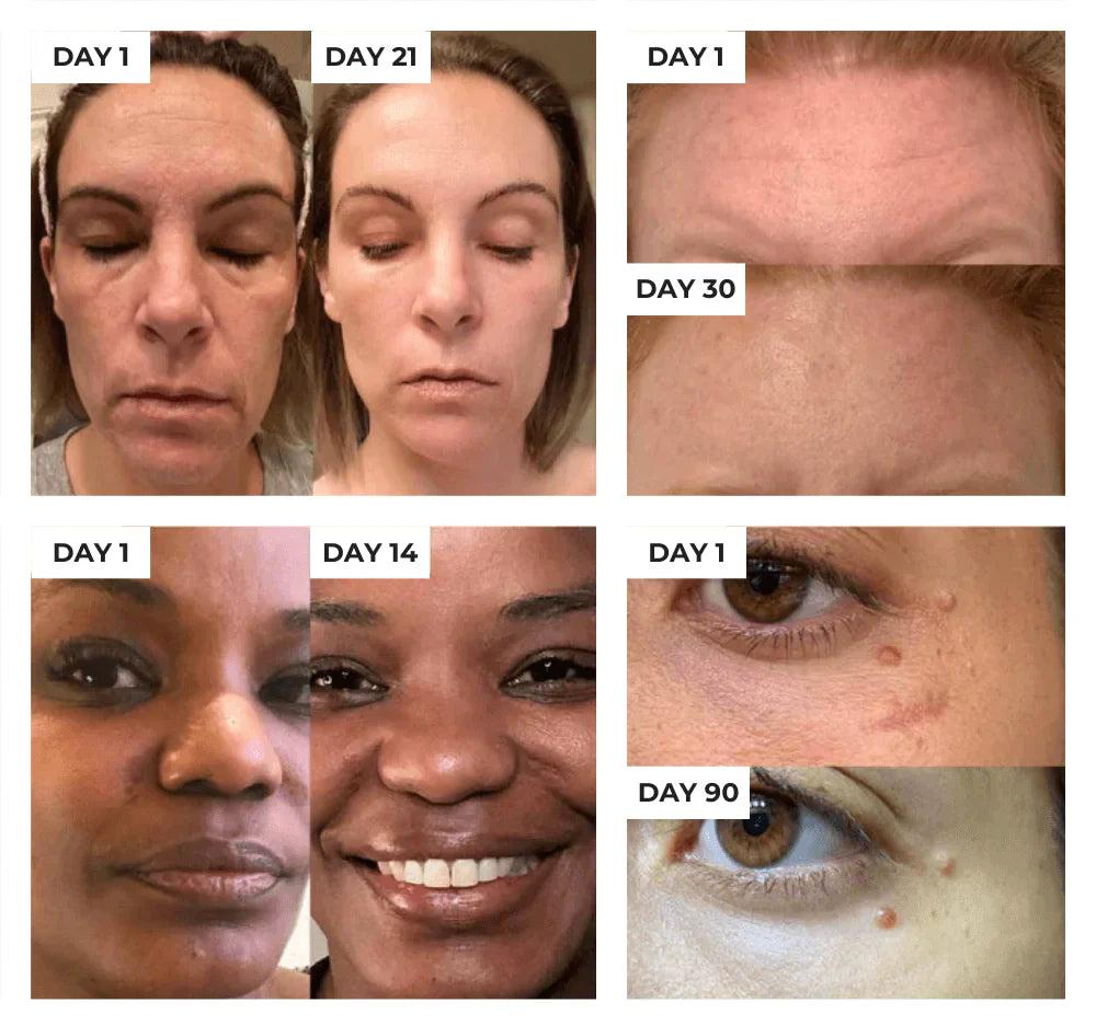 HexoSkin™ Anti-Aging Skincare Wand