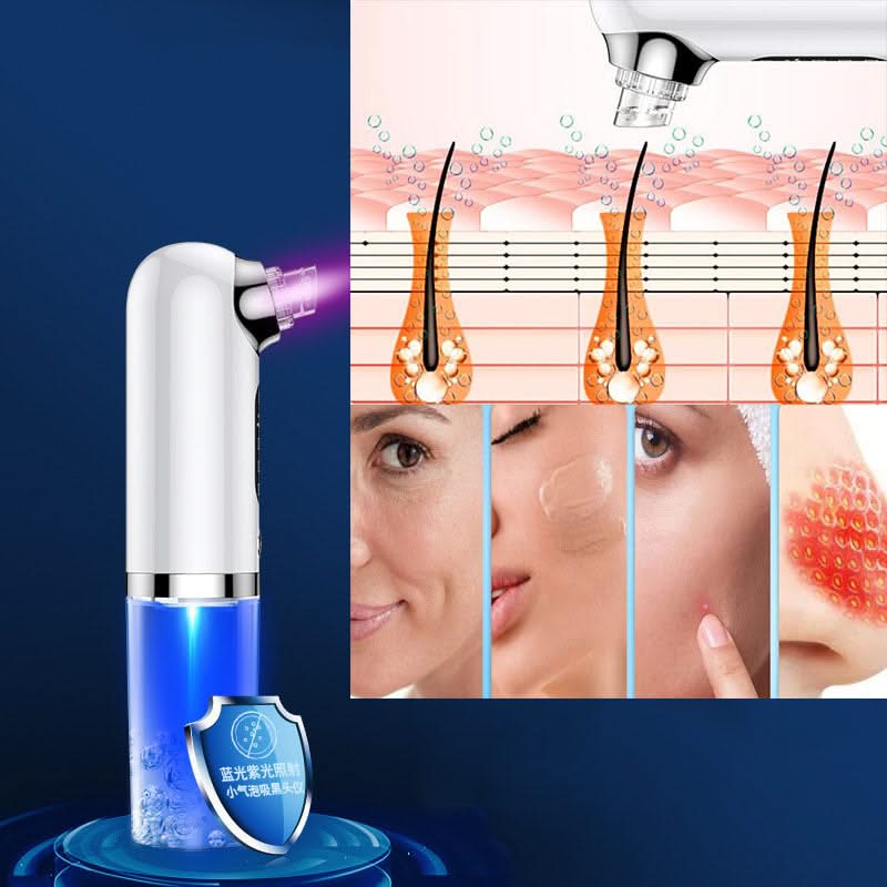 HexoSkin™ Microdermabrasion Deep Cleansing Blackhead Remover