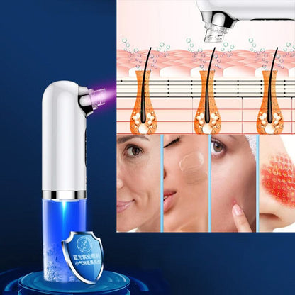HexoSkin™ Microdermabrasion Deep Cleansing Blackhead Remover