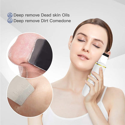 HexoSkin™ - Ultrasonic Blackhead Removing Skin Scrubber