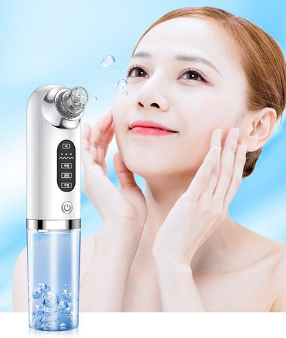 HexoSkin™ Microdermabrasion Deep Cleansing Blackhead Remover
