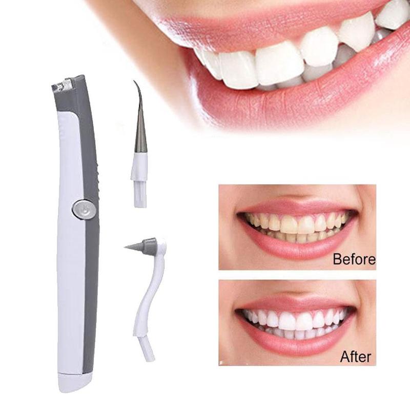 HexoTeeth™ - Electric Sonic Tooth Stain & Plaque Remover