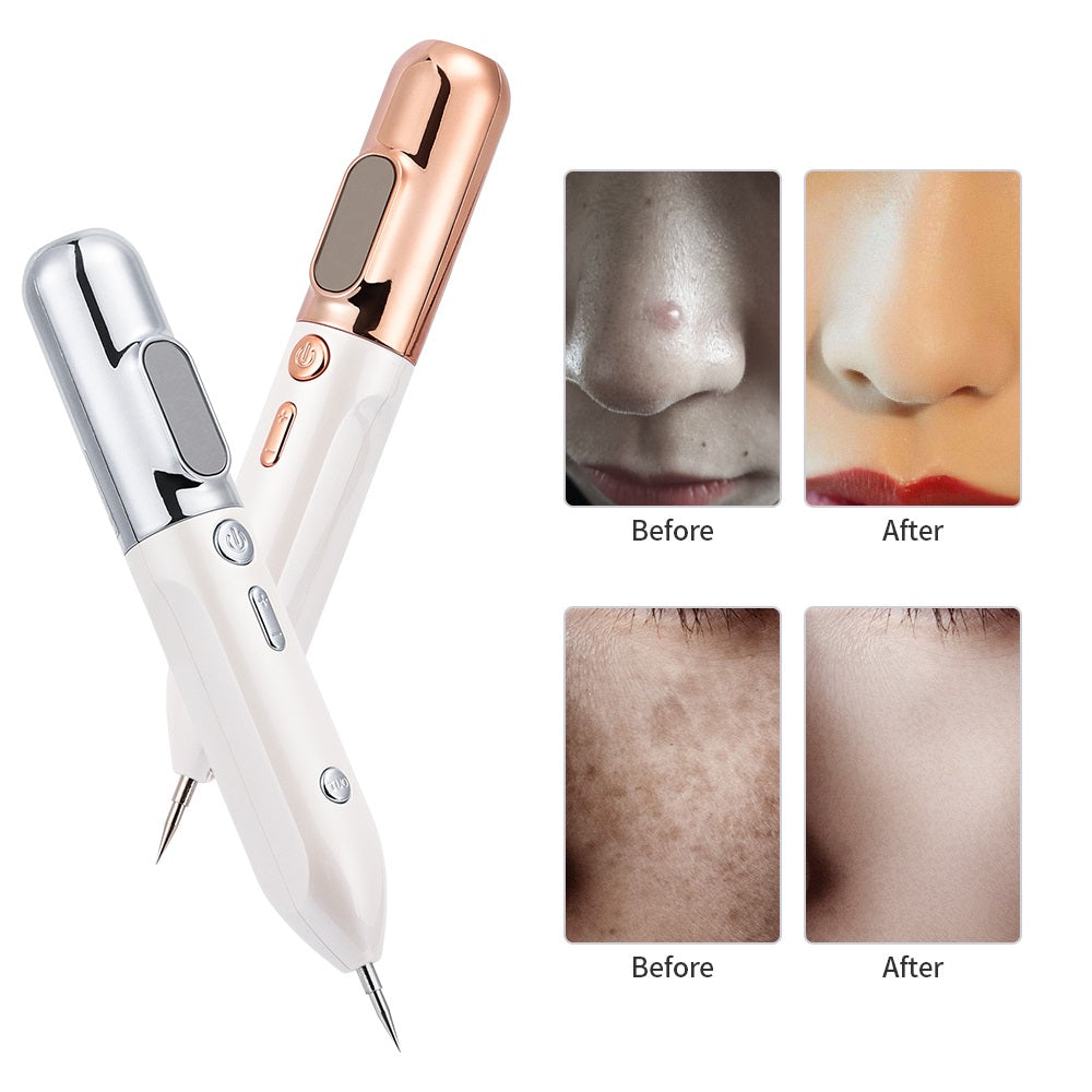 HexoPen™️ Mole & Skin Tag Removal Plasma Pen - Hexo Care International