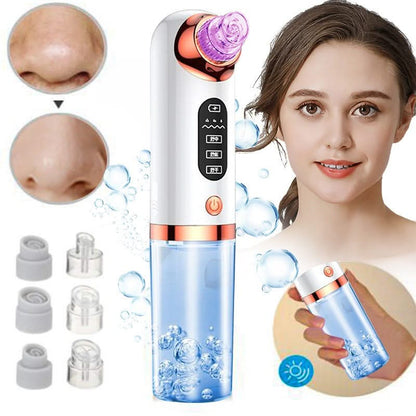 HexoSkin™ Microdermabrasion Deep Cleansing Blackhead Remover
