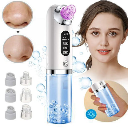 HexoSkin™ Microdermabrasion Deep Cleansing Blackhead Remover