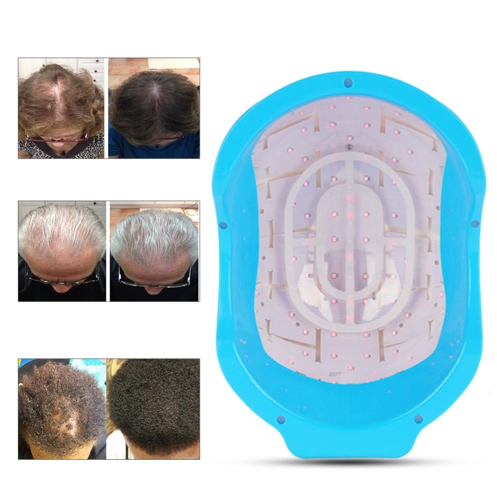 HexoGrow™ - Laser Hair Regrowth Helmet