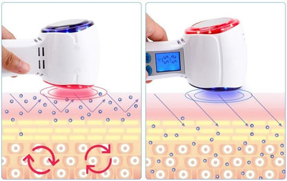 HexoCryo™ At-Home Facial Cryotherapy Device